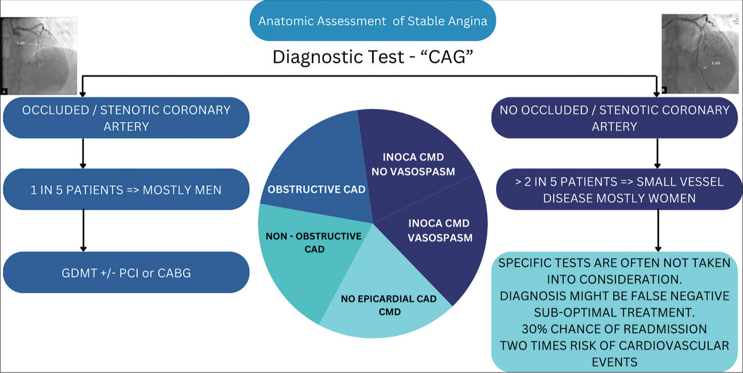 Clinical pathway of anatomic assessment of stable angina. CAG: coronary angiography, GDMT: guideline directed medical therapy, PCI: percutaneous coronary intervention, CABG: coronary artery bypass grafting, CAD: coronary artery disease, CMD: coronary microvascular dysfunction.